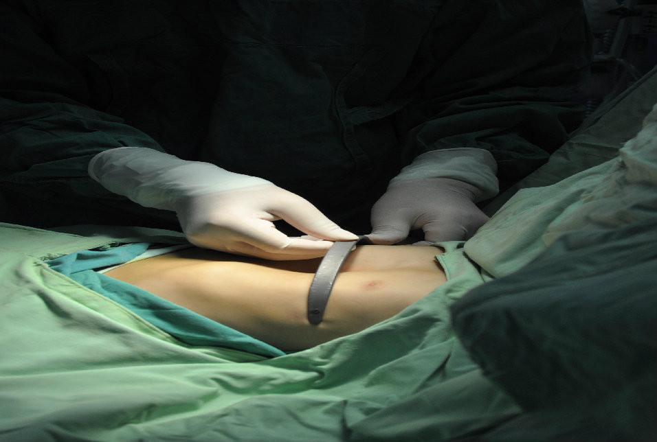 第二步：测试钛板大小。微调折弯器弧度。